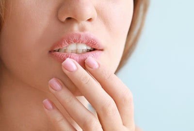 Preventing Chapped Lips This Winter