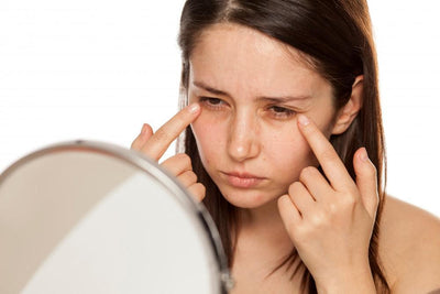 Dark Circles Under Your Eyes: How to Get Rid of Them